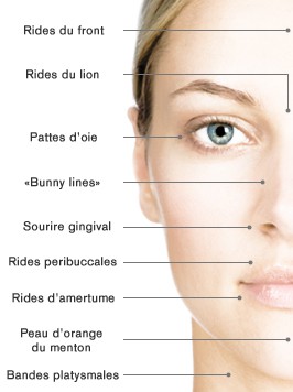 Conseils pour se débarrasser des rides de vieillissement et rides d’expression